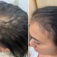 هنوزم دومبال کاشتی