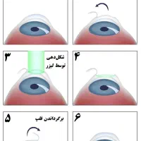 راهنمای لازک