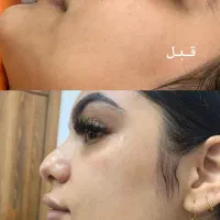 ناخن مژه بافت پاکسازی