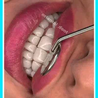 کامپوزیت دندان/ترمیم/دندانپزشکی/عصبکشی|خدمات آرایشگری و زیبایی|تهران, تهرانپارس شرقی|دیوار