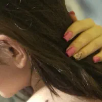 کاشت ترمیم ناخن
