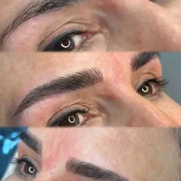 میکروبلدینگ وریمو