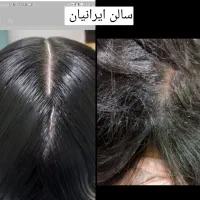 نیرو جهت کار دز سالن پاکسازی شپش|استخدام درمانی، زیبایی، بهداشتی|قم, علی آباد سعدگان|دیوار