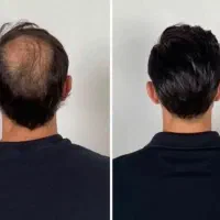 شونه دیگه لای موهات نمیره