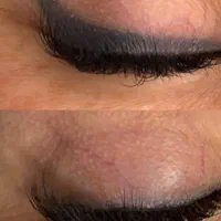 ریموو تتو های قدیمی|خدمات آرایشگری و زیبایی|بم, |دیوار