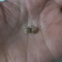 حلزون کلاژن ساز