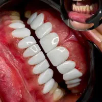 کامپوزیت و بلیچینگ با قیمت مناسب و کیفیت بالا|خدمات آرایشگری و زیبایی|اصفهان, سروستان|دیوار