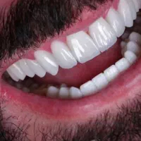 لابراتواردندان دولابی بااقساط