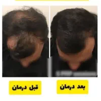 انواع شامپو و تقویت کننده مو و ضد ریزش و رویش مجدد