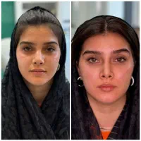 ژل وبوتاکس ،هایفو،پاک کردن تتو، دکتر جابری فر|خدمات آرایشگری و زیبایی|کرمانشاه, |دیوار