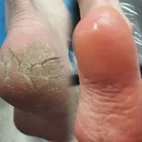 آموزش تخصصی پدیکور فقط با ۳تومن