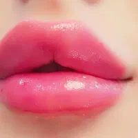 تزریق ژل وبوتاکس صورت