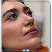 جشنواره تخفیفات جراحی بینی/عمل بینی|خدمات آرایشگری و زیبایی|کاشان, الغدیر|دیوار