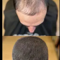 انقد بزن تا دربیاد