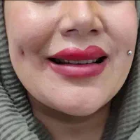 آموزش و انجام پیرسینگ چال گونه، میکرودرمال برازجان