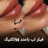 فیلر و بوتاکس وانزیم فیلر