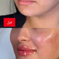 هایفو7 بعدی کل صورت999 هزارتومن|خدمات آرایشگری و زیبایی|اهواز, نادری|دیوار