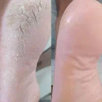 کفسابی/ پدیکور / + هدیه خفن|خدمات آرایشگری و زیبایی|اندیشه, اندیشه فاز ۱|دیوار