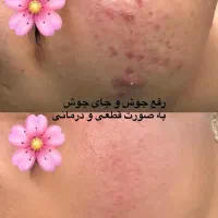 فیشال ۳۵۰ به مدت محدود،تمام خدمات به صورت حرفه ای|خدمات آرایشگری و زیبایی|صدرا-فارس, فاز ۱|دیوار