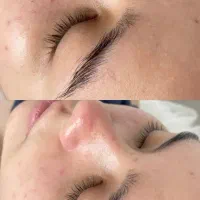 فیشیال و پاکسازی مخصوص خانمها و آقایون|خدمات آرایشگری و زیبایی|میبد, |دیوار