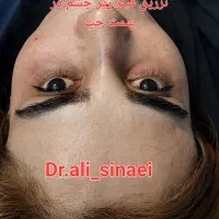 جشنواره تزریق فیلر و ژل و بوتاکس در قلب پزشکی مشهد|خدمات آرایشگری و زیبایی|مشهد, احمدآباد|دیوار