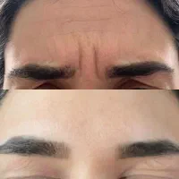 آموزش ژل و بوتاکس|خدمات آموزشی|شیراز, زرهی|دیوار
