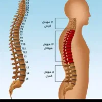 درمان کمر درد دیسک|پزشکی|ساوه, |دیوار