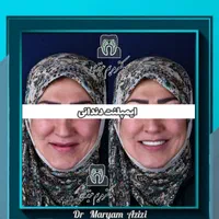 پایتخت ایمپلنت دندان دندانپزشکی تضمینی تعرفه دولتی|خدمات آرایشگری و زیبایی|شیراز, معالی‌آباد|دیوار