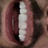 خدمات دنداپزشکی ری