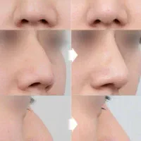 کرم کوچیک کننده بینی|آرایشی، بهداشتی، درمانی|قرقری, |دیوار