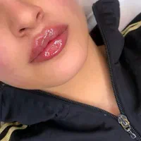 جشنواره ژل و بوتاکس|خدمات آرایشگری و زیبایی|شیراز, دلجو|دیوار