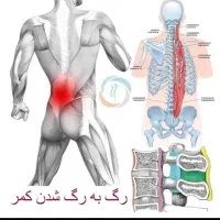 کمر درد دیسک سیاتبک کتف گردن