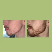 غذای ریش صورتت اینجاست