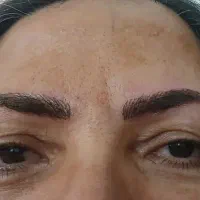 میکرو فیبروز شید لب خط چشم