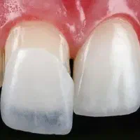 استخدام پذیرش و دستیار و کالسنتر دندانپزشکی