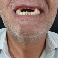 دندانسازی (ساخت دندان مصنوعی تعمیر دندان مصنوعی )|خدمات آرایشگری و زیبایی|تهران, مشیریه|دیوار