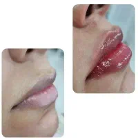 مدل رایگان جهت عکاسی فیبروز میکرو شیدینگ خط چشم