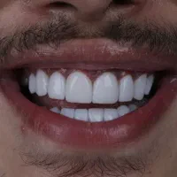 کامپوزیت و خدمات دندانپزشکی