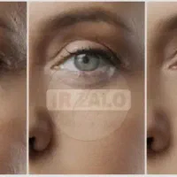 روغن درمانی|آرایشی، بهداشتی، درمانی|پاکدشت, پاکدشت (مامازند)|دیوار