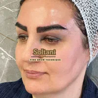 آفرمیکروکاشت ابروتضمینی تنهامتد(فاین برو)نقدواقساط