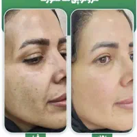 اموزش لاین زیبایی پر درامد برای خانم هاو اقایان