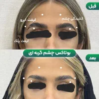 مدل بوتاکس برای سه شنبه و چهارشنبه