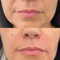 کلینیک تخصصی اپانا لیزر ده بزرگی روشن سازی و..|خدمات زیبایی و سلامت|شیراز, فرهنگ شهر|دیوار
