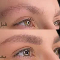 انجام میکرو بلیدینگ ابرو
