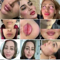 تکنسین زیبایی هستم ، آماده همکاری با کلینیک عراق