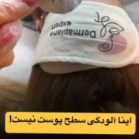 پاکسازی پوست فیشیال