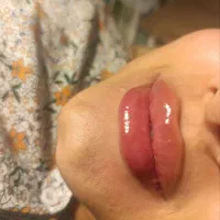 ژل لب و کاشت ناخون