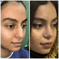عمل جراحی بینی پیکرتراشی لیپوساکشن ابدو اسلیو قسطی|خدمات زیبایی و سلامت|تهران, نیاوران|دیوار