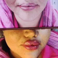 ژل بوتاکس پی از پی مزو فیشال میکرو فیلر بیکنی|خدمات آرایشگری و زیبایی|مشهد, فرهنگیان (شهرک غرب)|دیوار