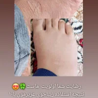 اگه ازترک پوستی رنج میبری پیام بده|فعالیت داوطلبانه|یزد, |دیوار